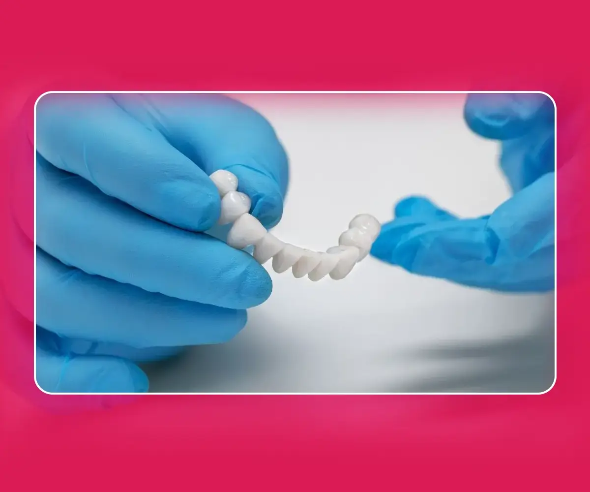 Dental Crown & Bridges Treatment